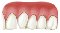 alloderm_patient_caseb